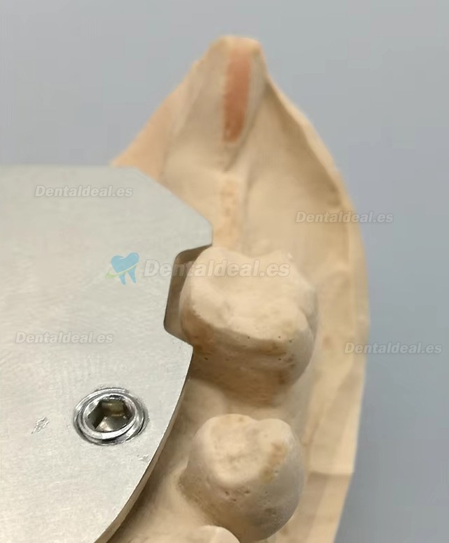 Registrador Relaci&oacute;n C&eacute;ntrica con Trazador Arco G&oacute;tico para Ed&eacute;ntulos